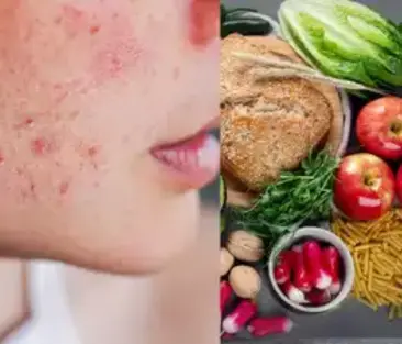skin health